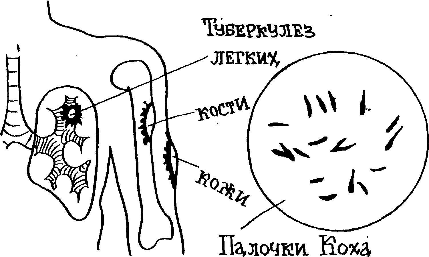 Строение микобактерии туберкулеза схема